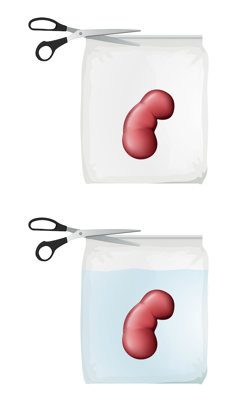 Stand-up vacuum-sealed bags
