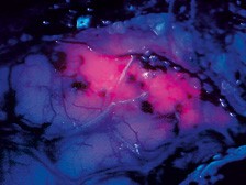 BLUE-400-intraoperative-Fluorescence-B-224x168小圖二.jpg