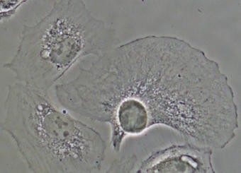 BSC-1 cells captured with CFI S Plan Fluor ELWD ADM 40xC objective