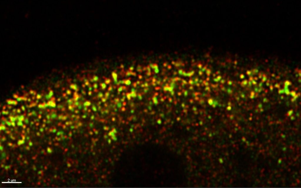 Protein-Clusters-Germ-Granules-1024x639.jpg