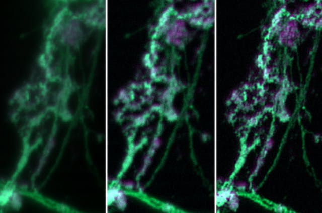 zeiss-apotome-3-deconvolution.ts-1602250473338.jpg