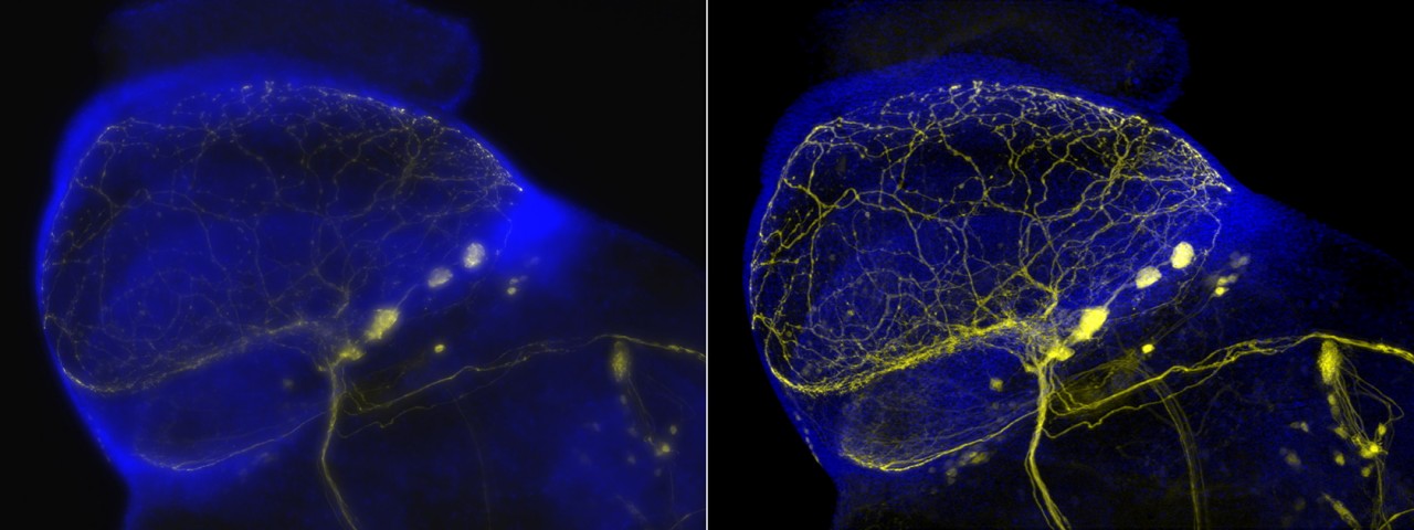 zeiss-apotome-3-drosophila-neurons.jpg