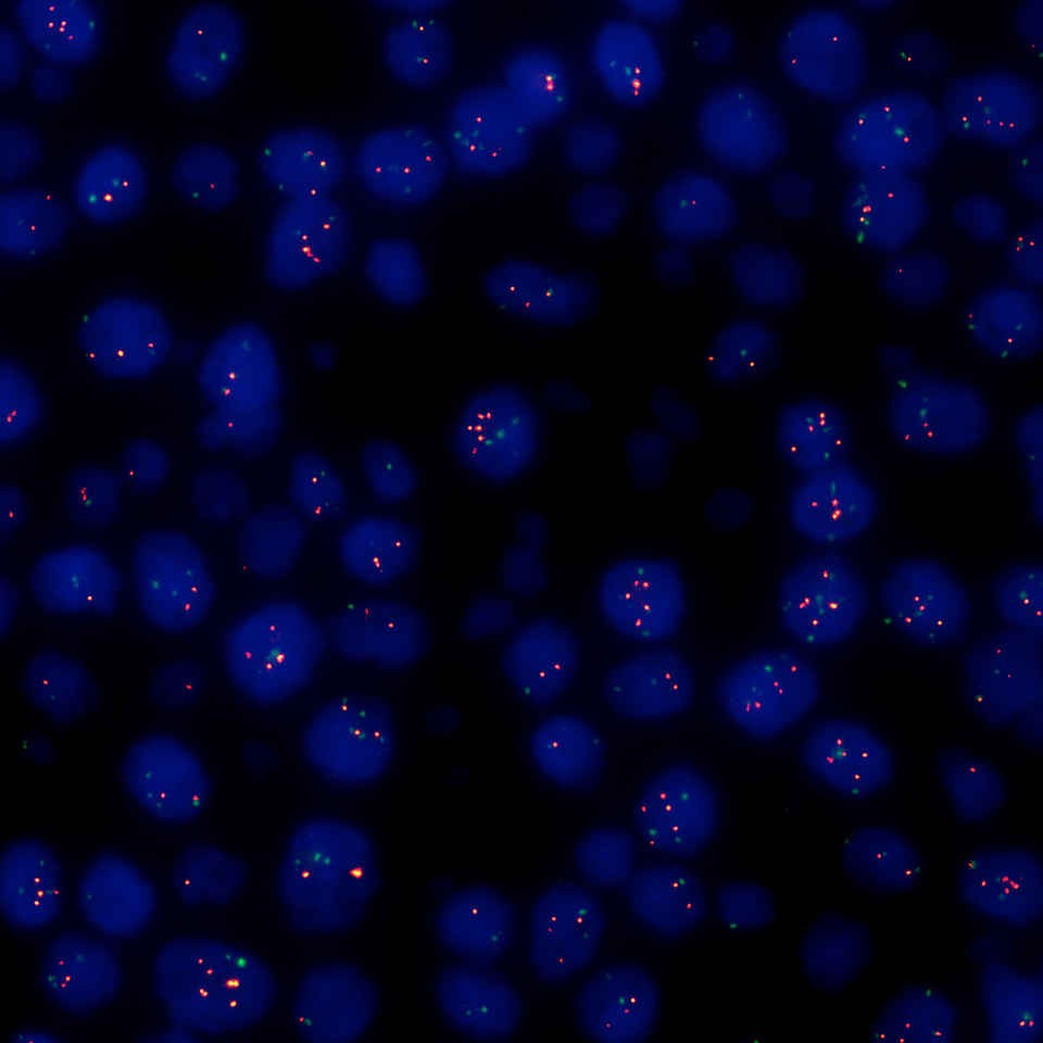 100X-D_DLEDI_C_FITC-ORANGE-DAPI_f93403bc6157097c2aa6433e47c2abdd.jpg