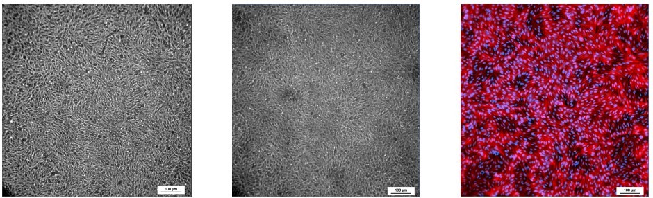 表皮細胞-使用正立顯微鏡.jpg