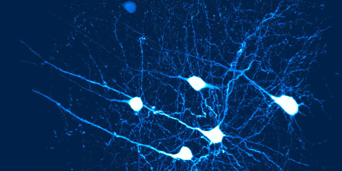 預熱信 EDM_Mouse Brain_1200.png