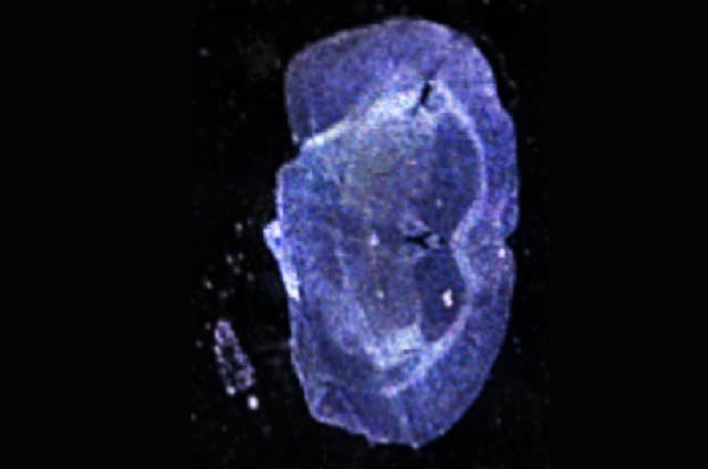 zeiss-ai-sample-finder-overview-image-darkfield.ts-1602679314295.jpg