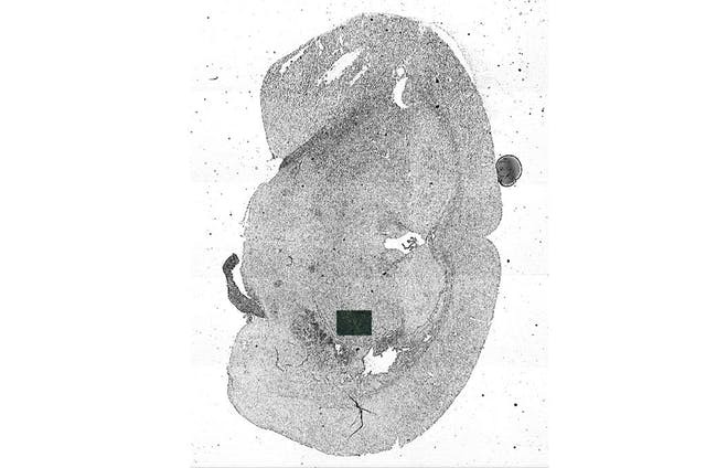 zeiss-ai-sample-finder-overview-image-coherence-contrast.ts-1602679316440.jpg