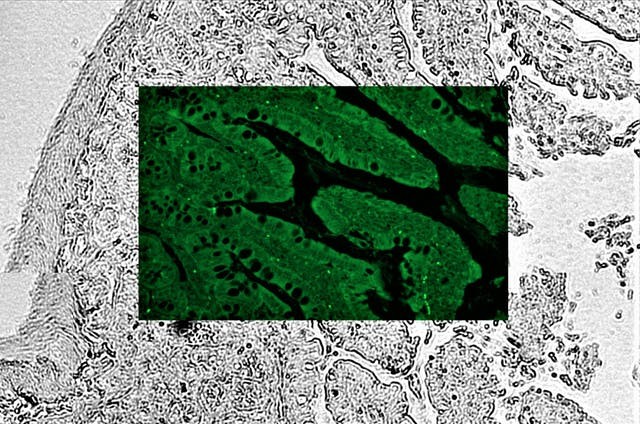 zeiss-ai-sample-finder-overview-image-combination-fluorescence-coherence-contrast.ts-1602679317139.jpg