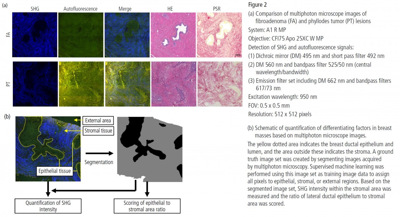 臨床研究_利用多光子顯微鏡的無標定成像技術應用於乳腺腫瘤診斷影像_情境1.JPG